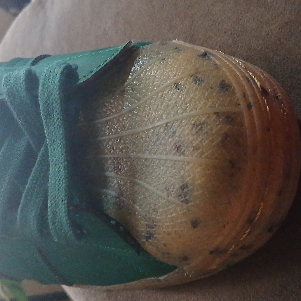 Adidas Forest Green Sneakers with Speckled Sole - Picture 7 of 9